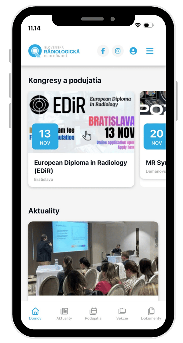 Mobilná aplikácia SRS